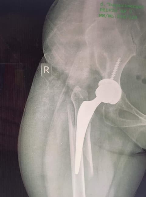 Хугарал засах мэс засал image10