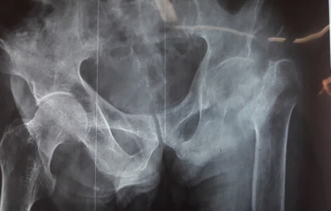 Түнхний үе солих мэс засал гэж юу вэ image12