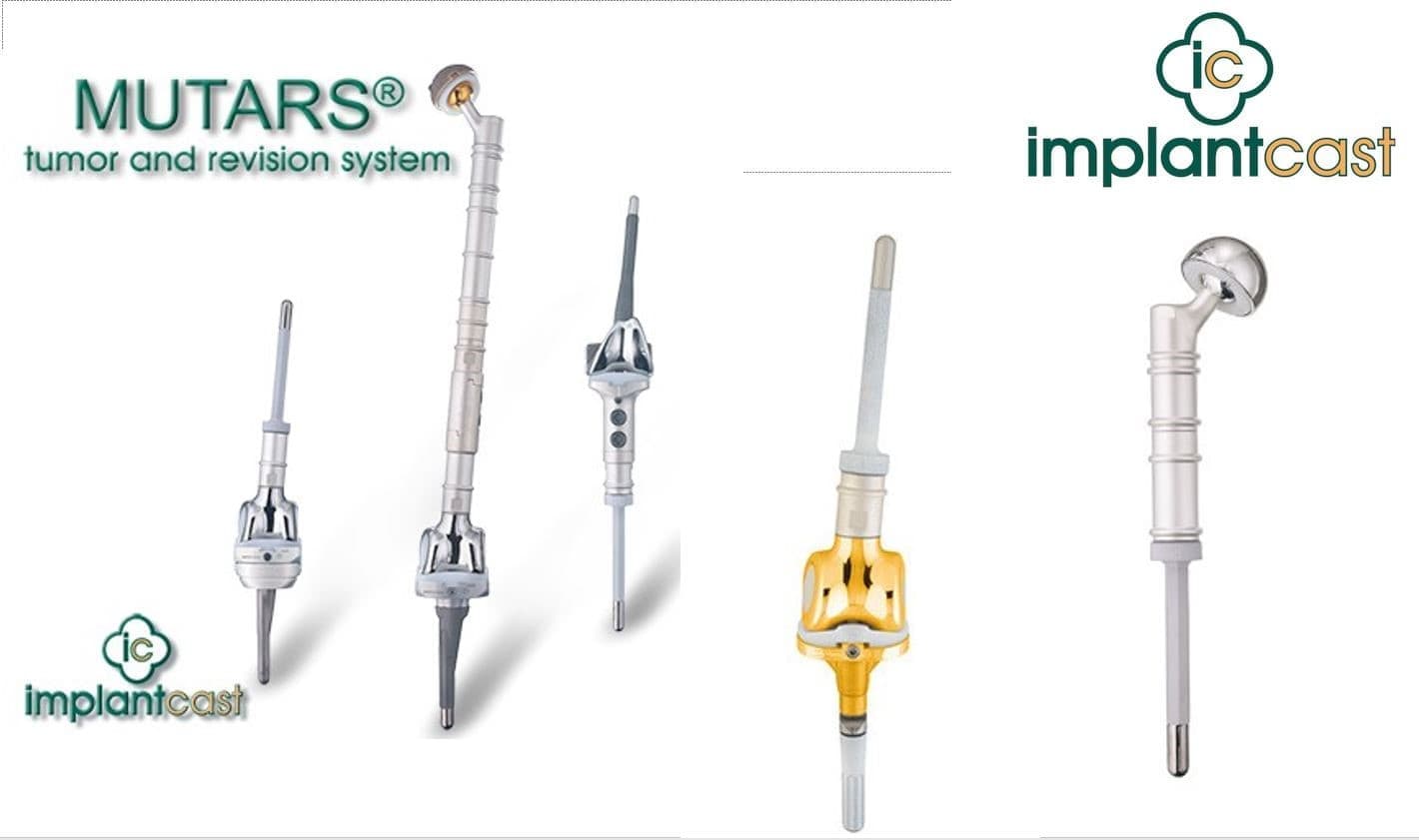 Үе дайрсан ясны анхдагч хавдар, ясны дутмагшлын үед хийгдэх мэс засал image2
