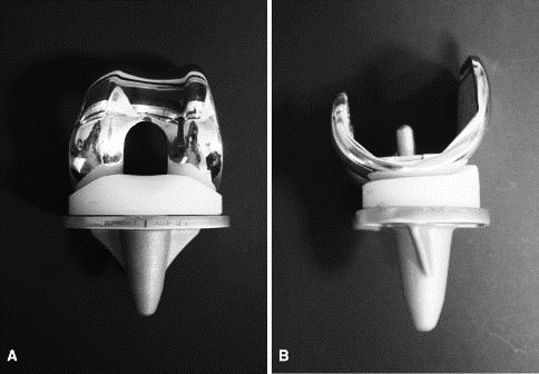 Өвдөгний үе бүтэн солих мэс засал (TKA) image3