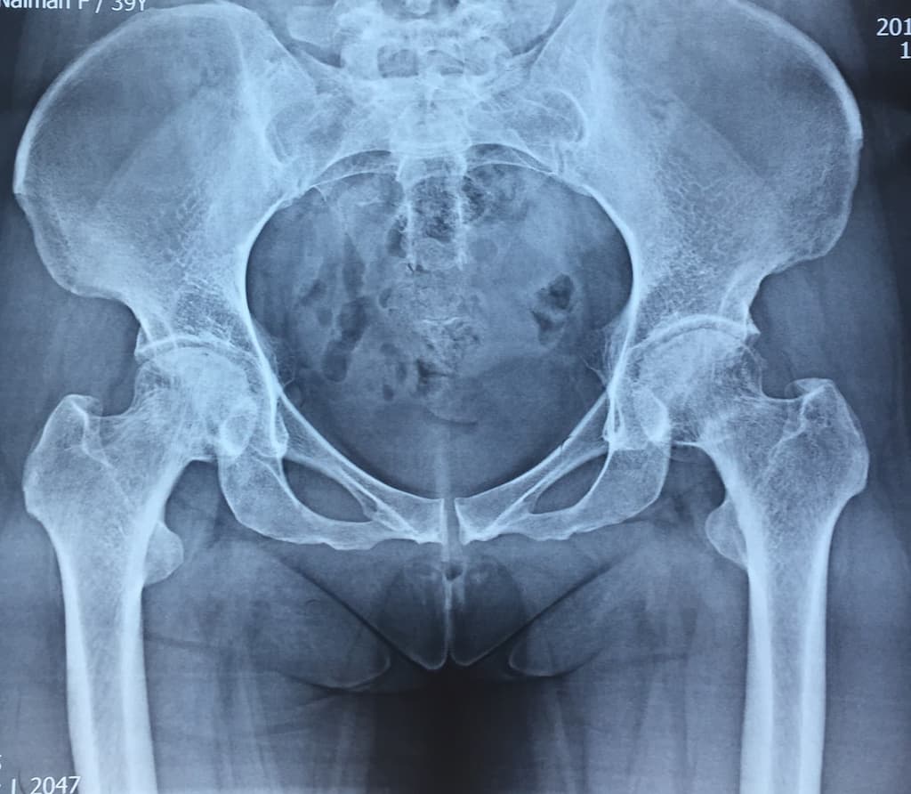 Түнхний үе солих мэс засал гэж юу вэ image4